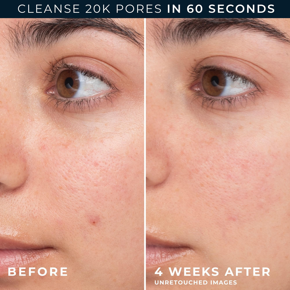 RoC Barrier Renew ingredients with ceramides, green tea and glycerin for balanced skin.