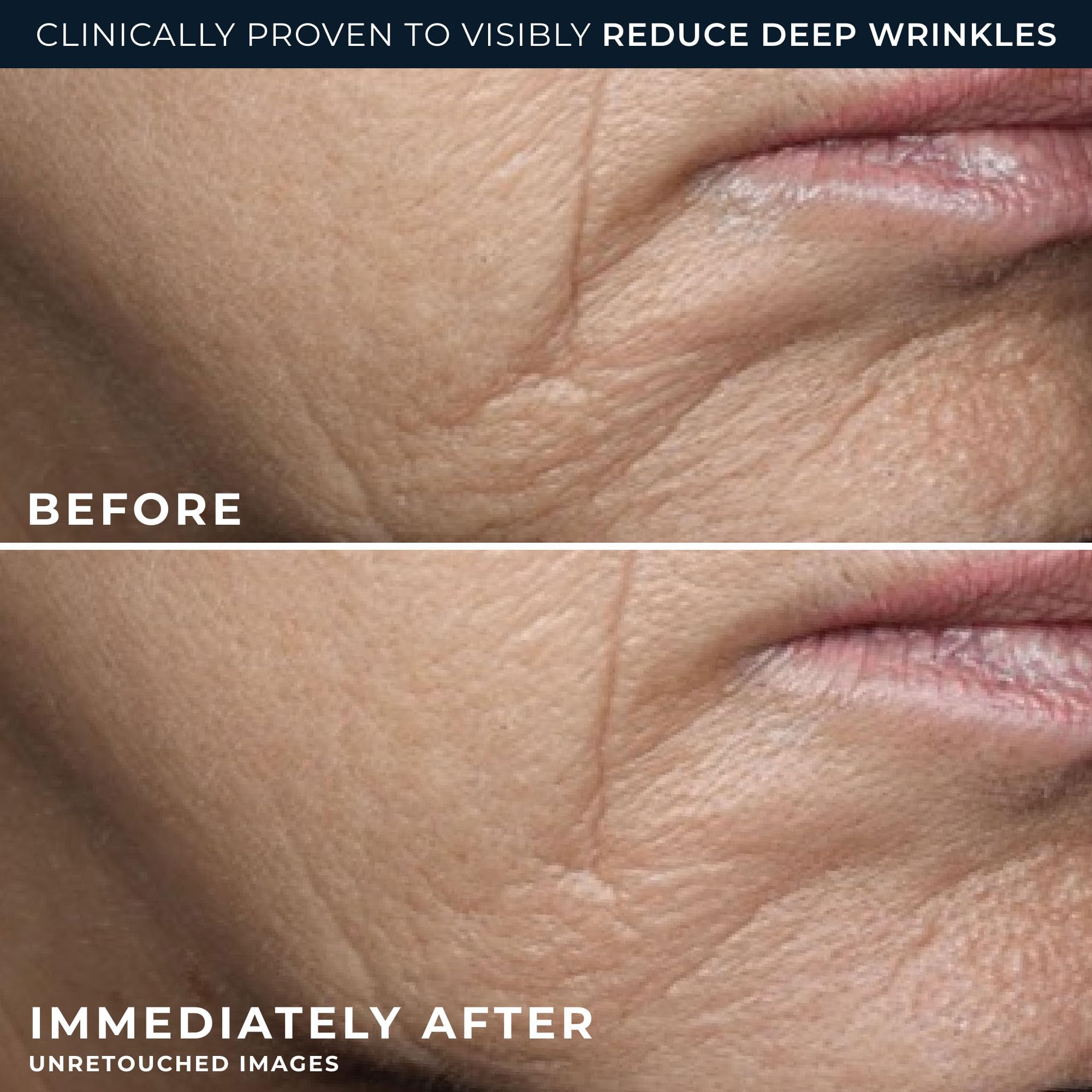 RoC Deep Wrinkle Rich Cream bottle application shot reveals smooth skin feel