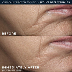 RoC Deep Wrinkle Rich Cream bottle application shot reveals smooth skin feel