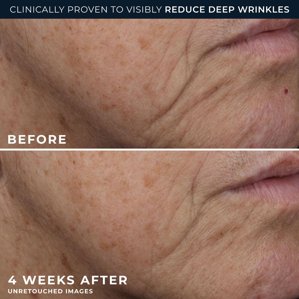 RoC Deep Wrinkle Rich Cream eye packette included for cohesive routine