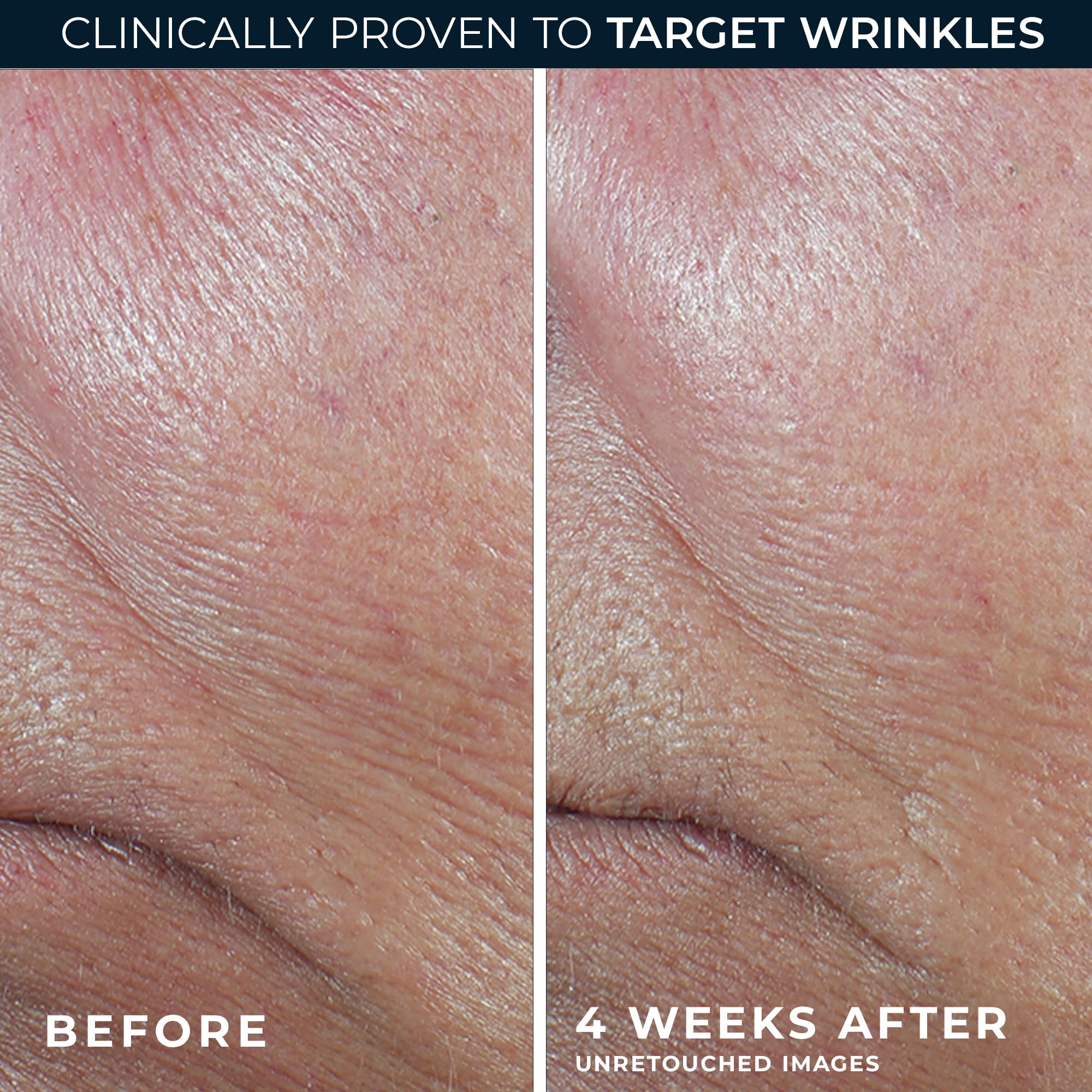 RoC serum stick on cheeks for even texture.