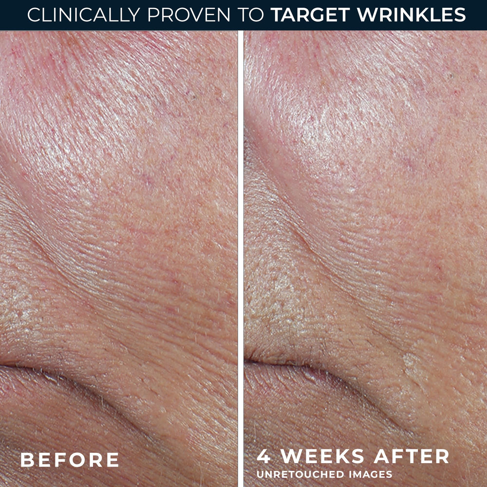 RoC serum stick on cheeks for even texture.