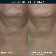 RoC Derm Correxion neck cream daily application demonstrates easy morning routine and skin plumpness