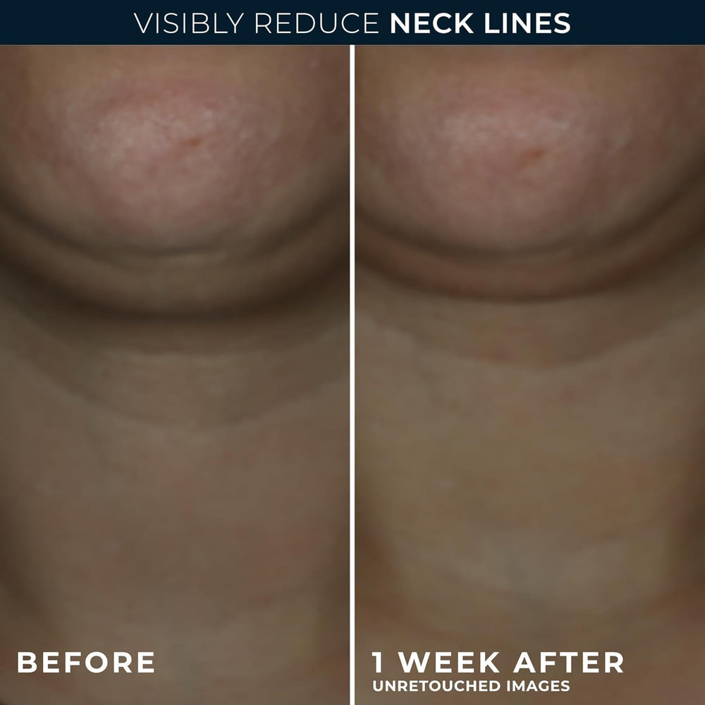 RoC Derm Correxion neck cream hyaluronic acid boost close up texture highlights hydration benefits