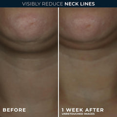 RoC Derm Correxion neck cream hyaluronic acid boost close up texture highlights hydration benefits
