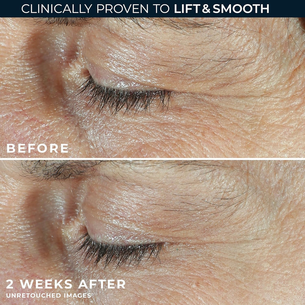 RoC Derm Correxion retinol peptides blend targets all eye areas for a refreshed contour.