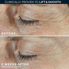 RoC Derm Correxion retinol peptides blend targets all eye areas for a refreshed contour.