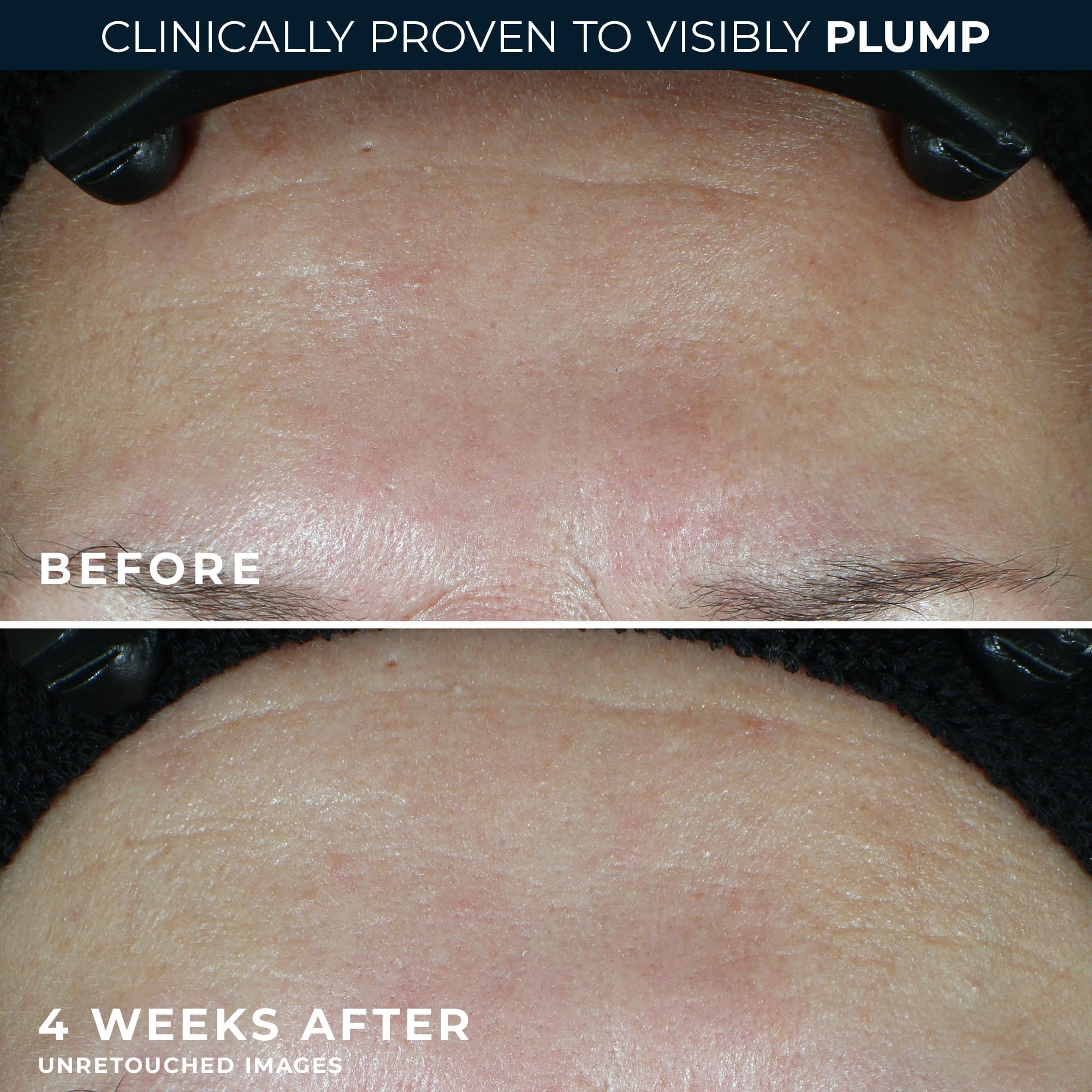 RoC dual-pack display showing moisturizer and eye cream for streamlined routine.