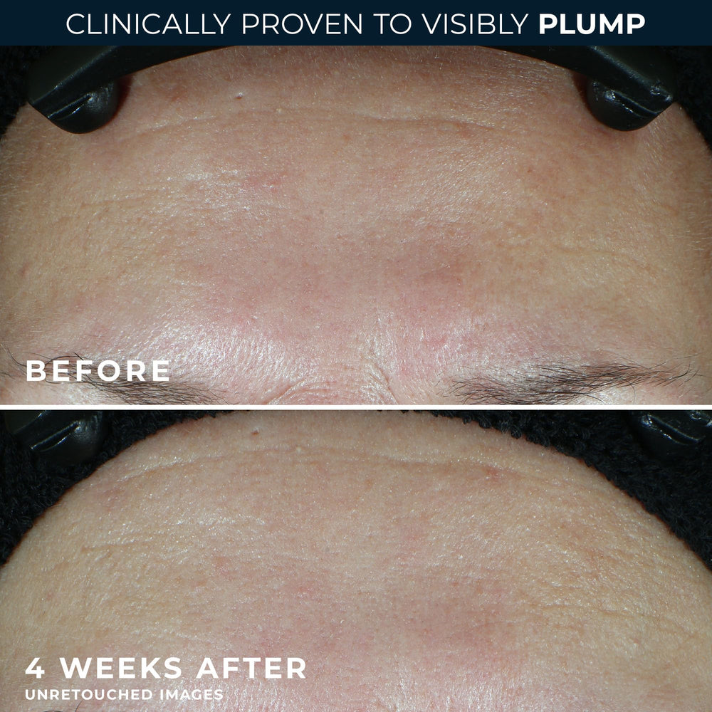 RoC dual-pack display showing moisturizer and eye cream for streamlined routine.