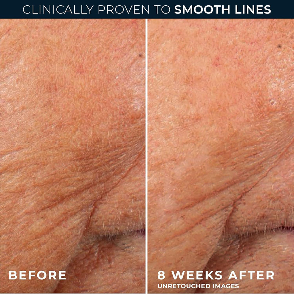 RoC fragrance-free, dermatologist-tested label supports sensitive skin use