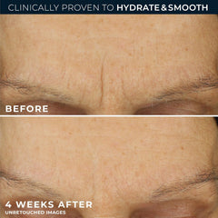 RoC hyaluronic acid visual diagram clarifying moisture retention for plump-looking skin