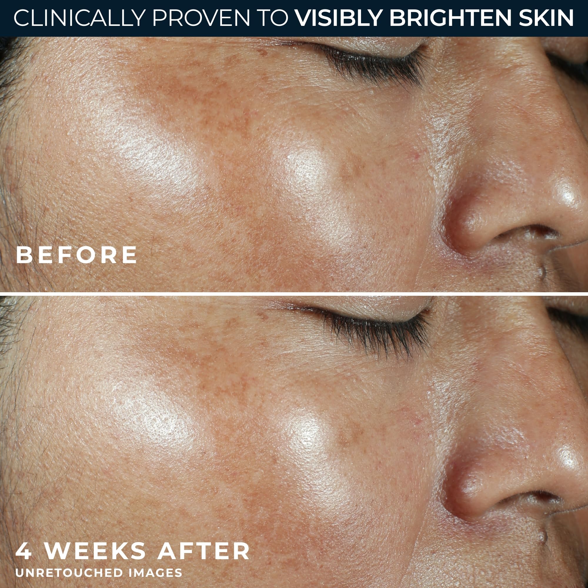 RoC lightweight non-greasy moisturizer absorbed on skin