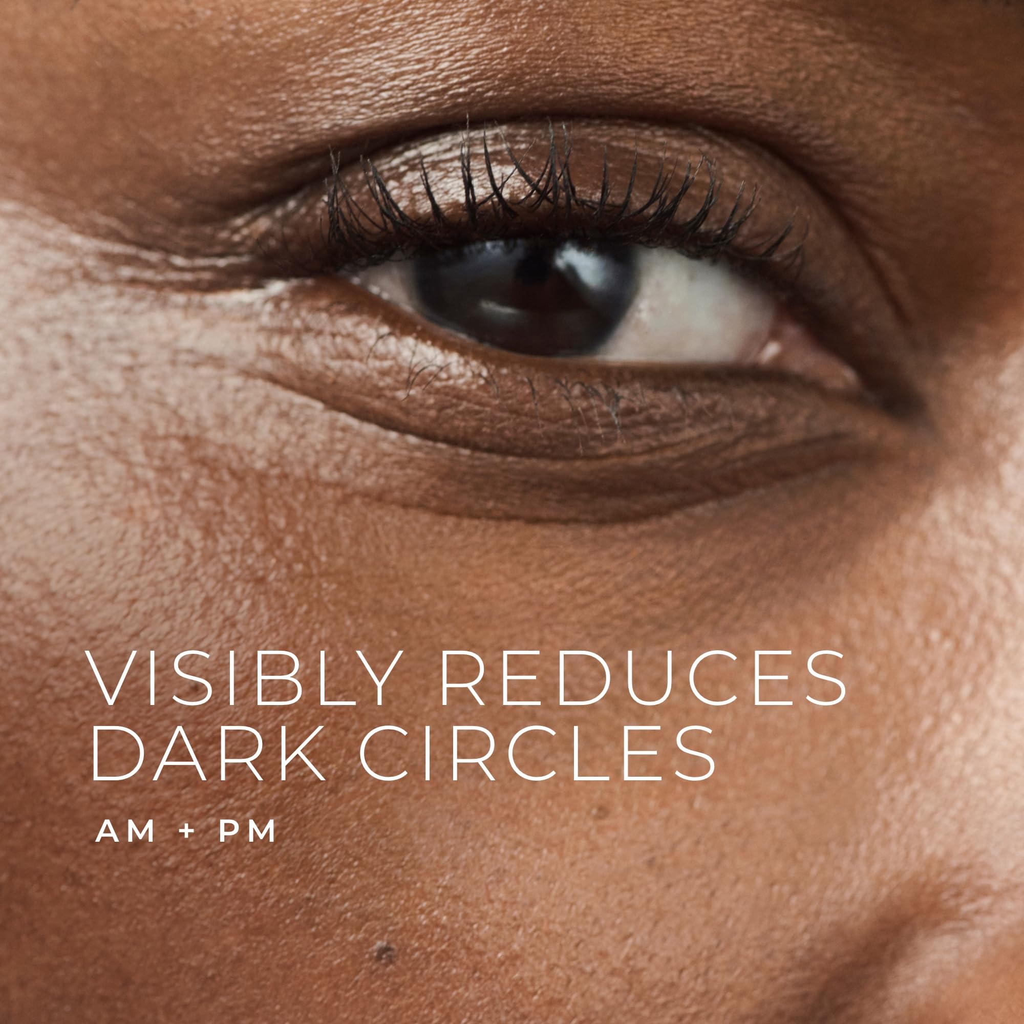 RoC eye cream under-eye bags close-up showing potential smoothing effect.