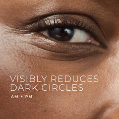 RoC eye cream under-eye bags close-up showing potential smoothing effect.