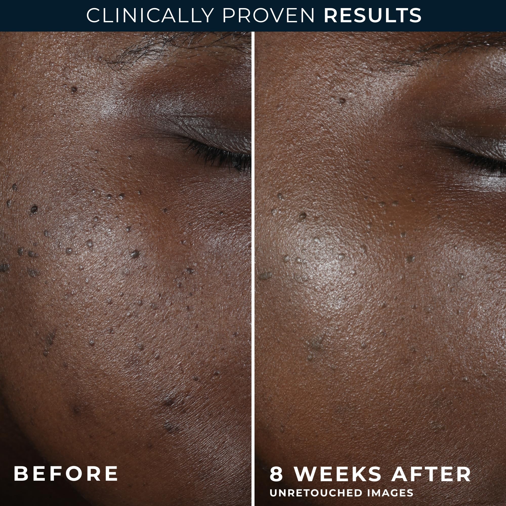 RoC night cream glow as formula settles on skin.