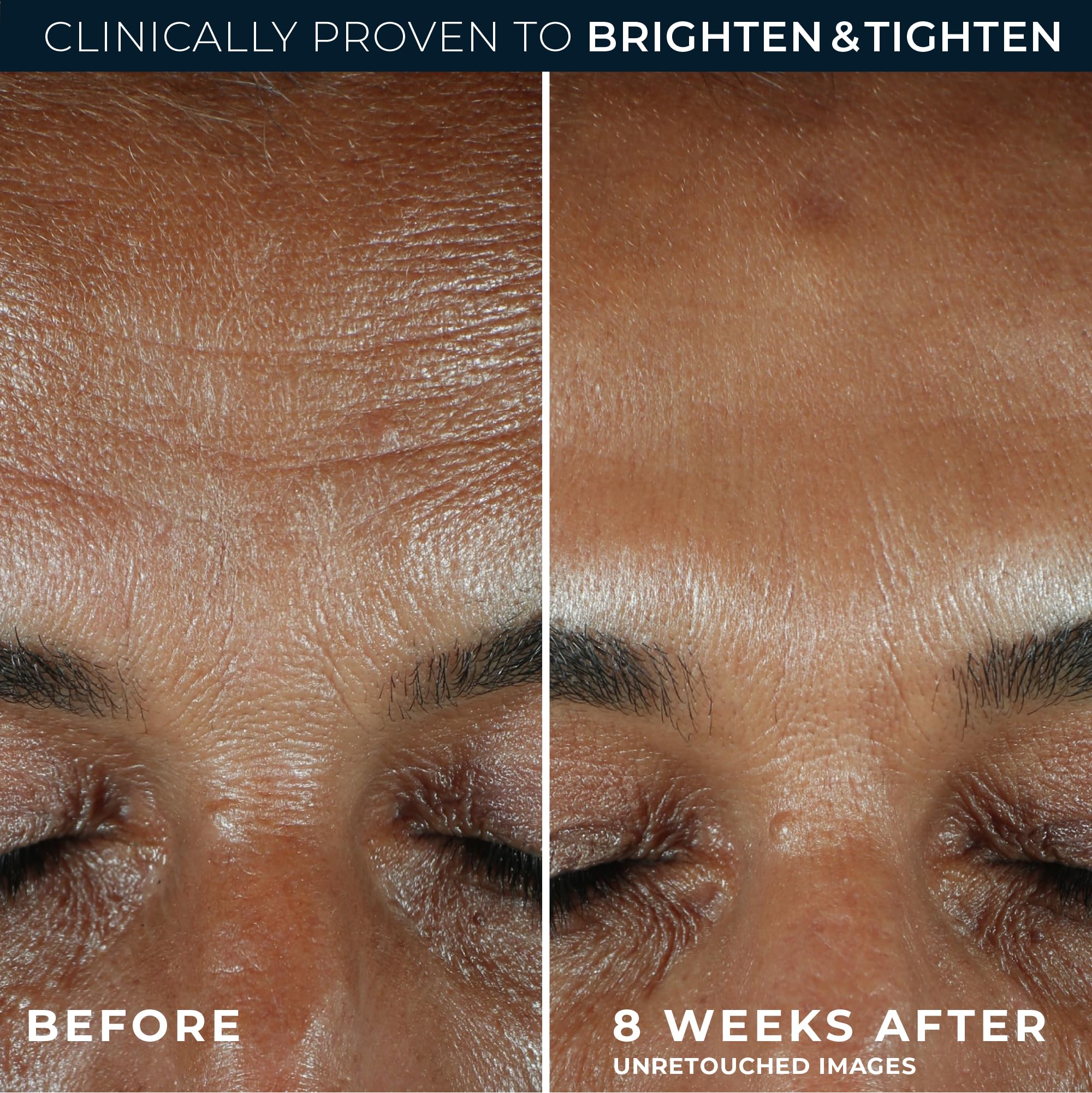RoC Revive + Glow clinical results graphic hints at rapid luminosity improvements.