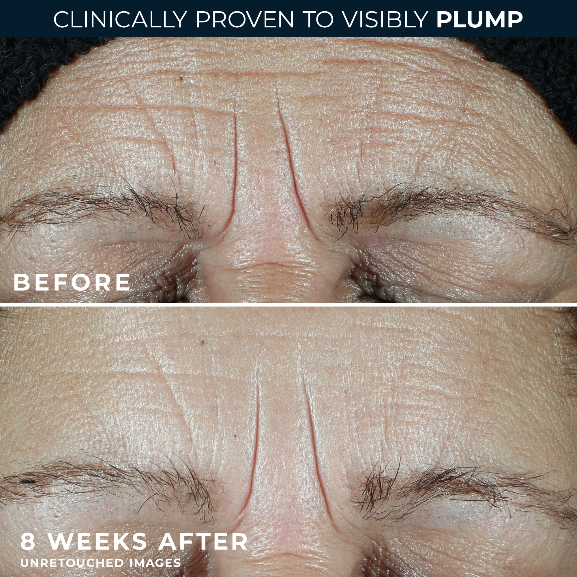 RoC non-comedogenic formula close-up suitable for daily use.