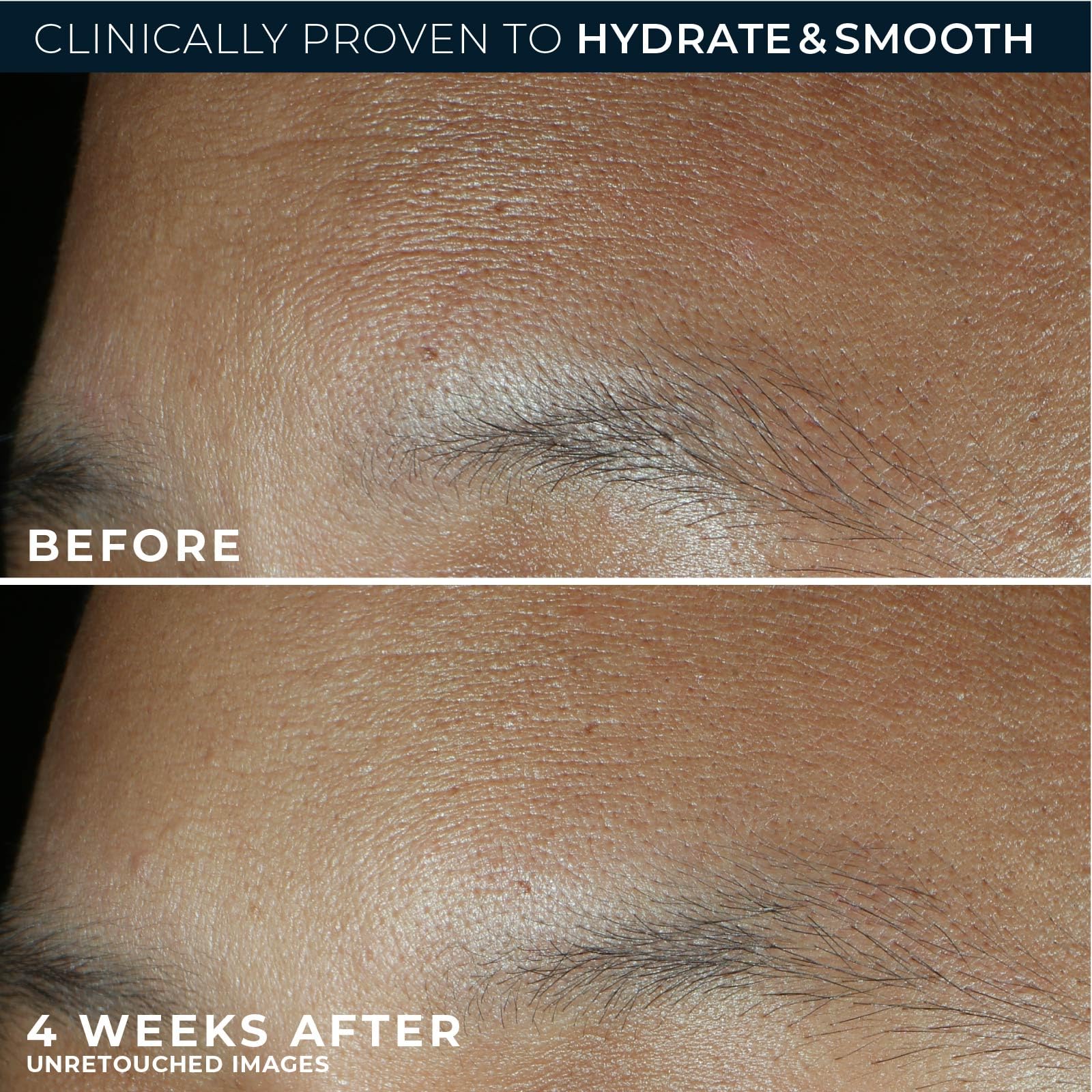 RoC oil-free non-comedogenic emblem on jar communicates pore-friendly hydration