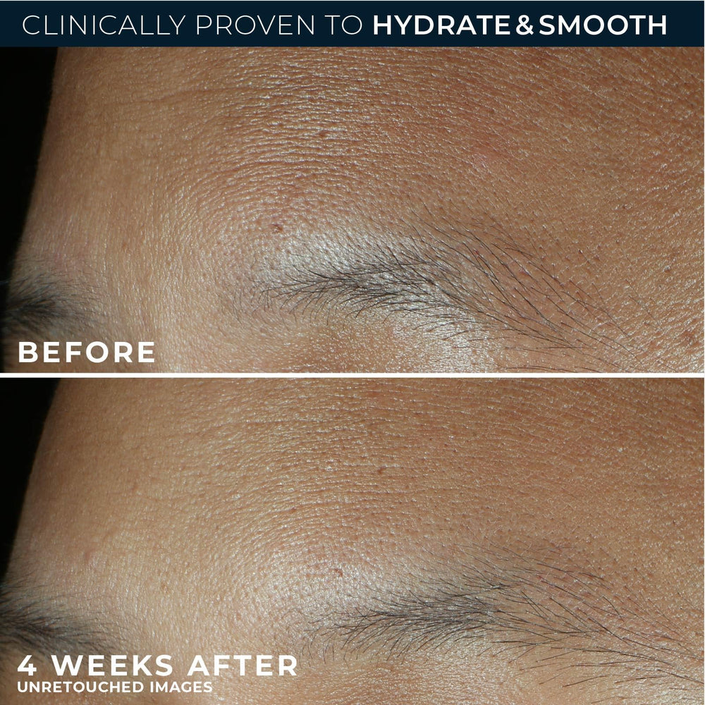 RoC oil-free non-comedogenic emblem on jar communicates pore-friendly hydration