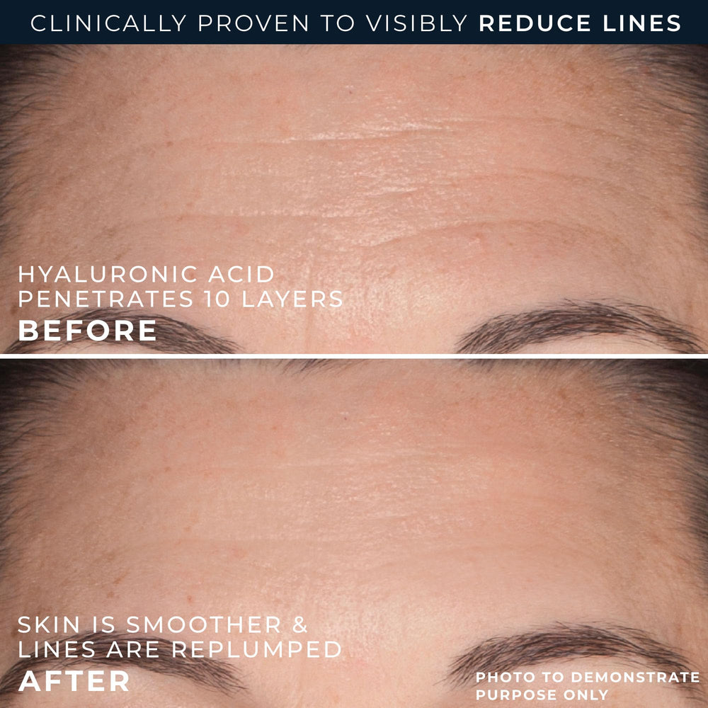 Pro-Collagen peptides support skin firmness and reduce appearance of lines