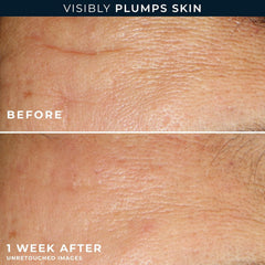 RoC Retinol Capsules bottle close-up signaling anti-aging care