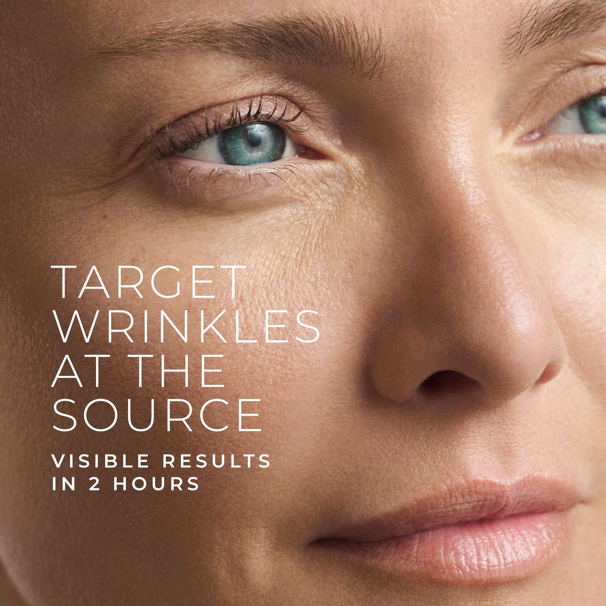 RoC patch applied between the brows for smoothing 11 lines.