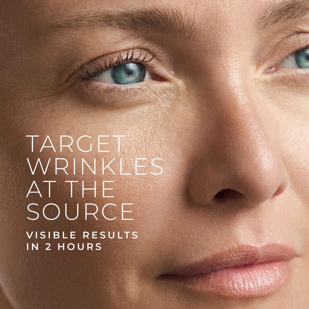 RoC patch applied between the brows for smoothing 11 lines.
