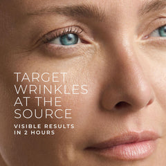 RoC patch applied between the brows for smoothing 11 lines.