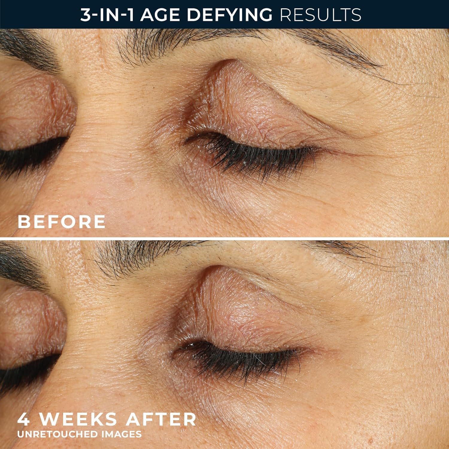 RoC Retinol Correxion eye cream in daily routine scene