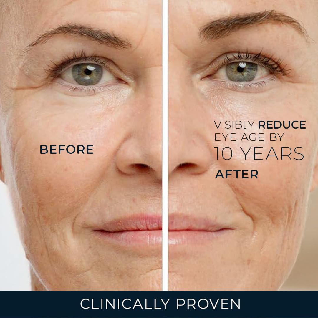 RoC eye cream usage step demonstrates dab application on orbital area