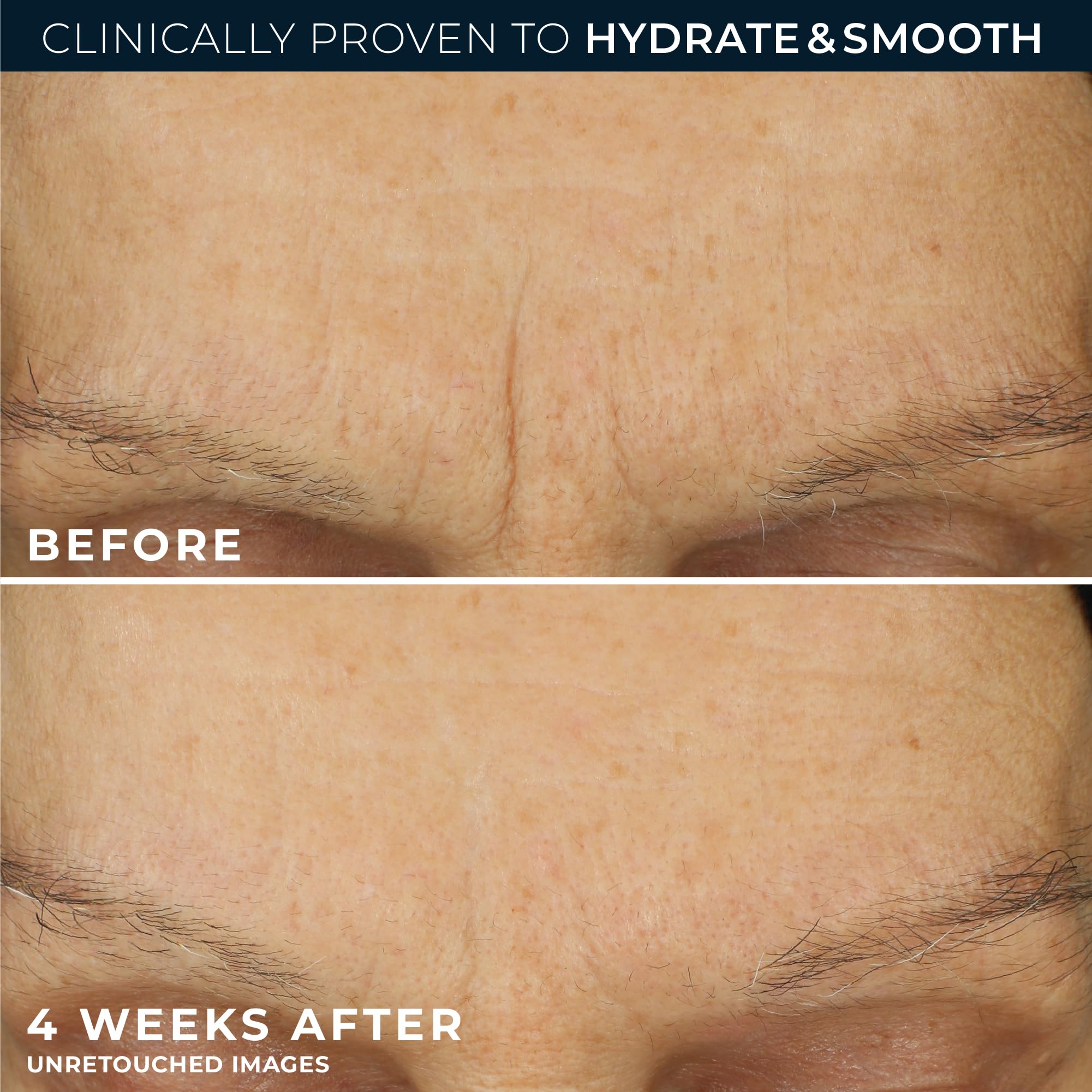 RoC Retinol Correxion Max Hydration tube reveals oil-free texture.