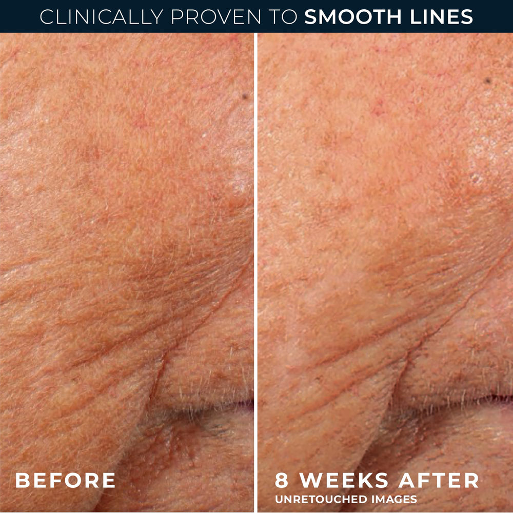RoC Retinol Correxion night application routine scene showing simple nightly use