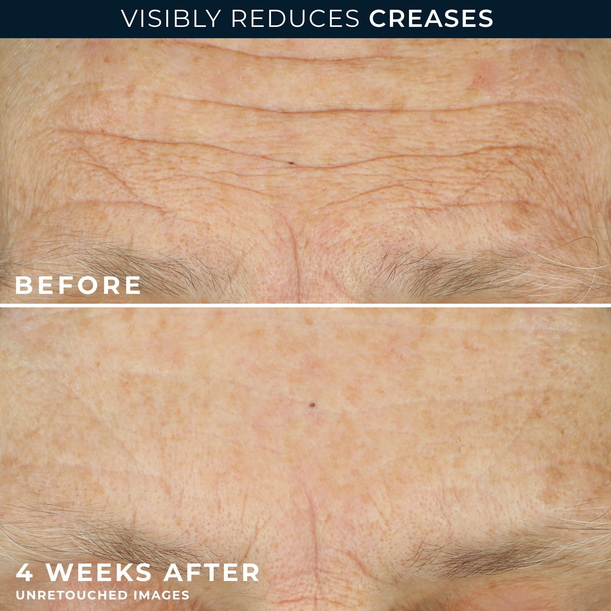 Open RoC retinol capsules showing individual capsules for controlled use