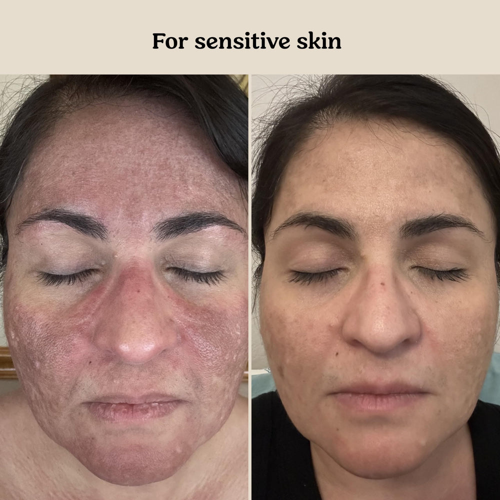 Roe Wellness antioxidant-rich formula helps shield skin during routine care.
