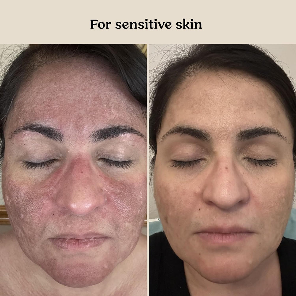 Roe Wellness Baby Cream application on arm shows gentle spreading and absorption