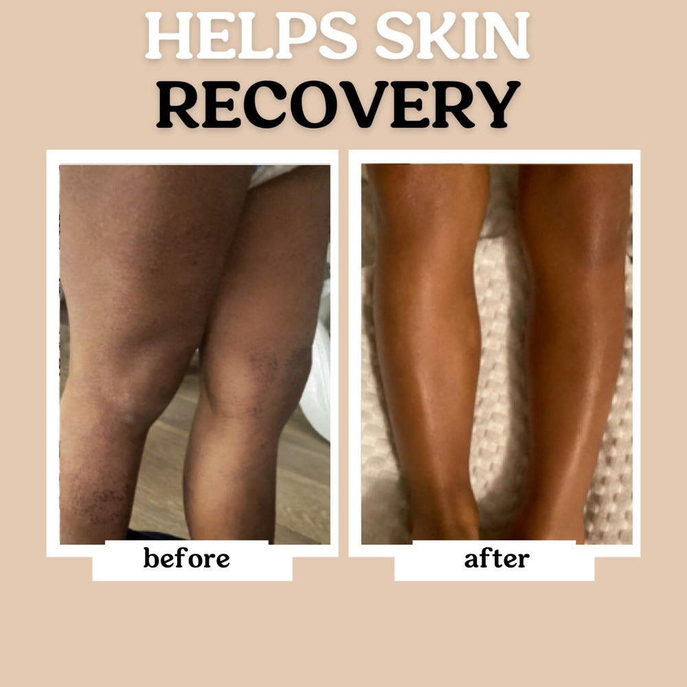 Roe Wellness soft-skin application on baby arm for soothing care.
