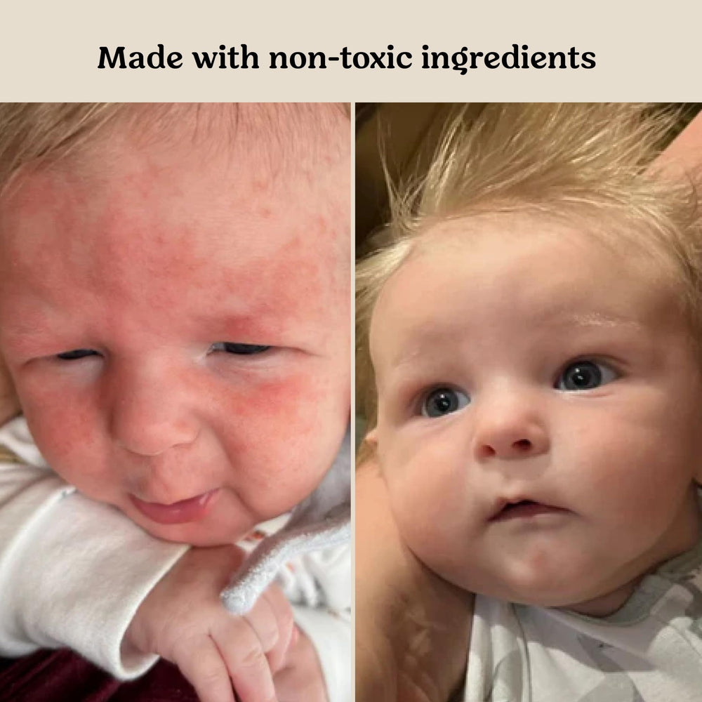 Roe Wellness non-toxic ingredients ensure safe, everyday use on sensitive skin.