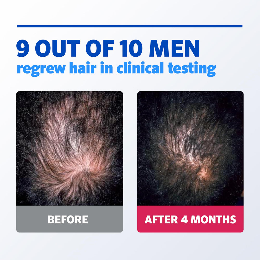 Unscented foam on a clean, dry scalp absorbs quickly.