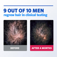Unscented foam on a clean, dry scalp absorbs quickly.