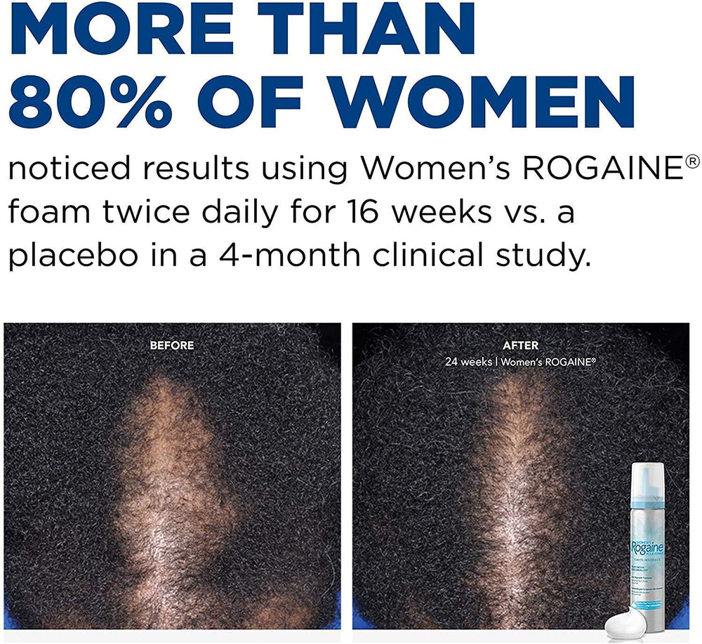 Rogaine unscented foam packaging communicates fragrance-free use