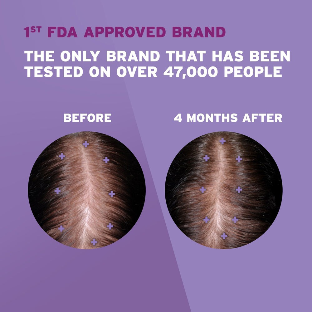 Rogaine Women’s 2% Minoxidil being applied to the scalp for targeted treatment