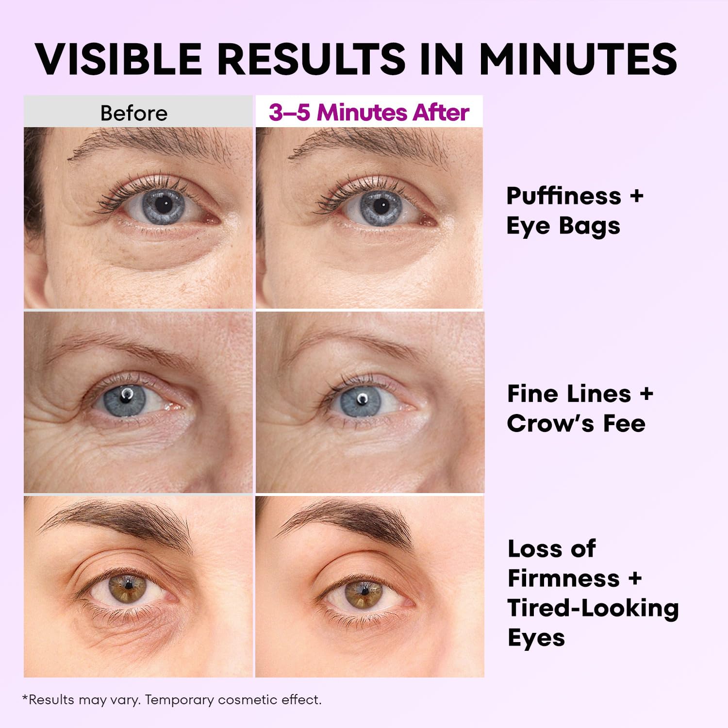 Applying RONKIE under the eye for a refreshed, alert look.