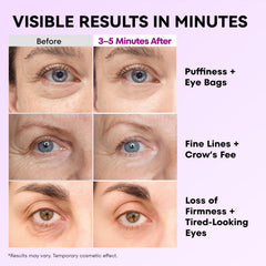 Applying RONKIE under the eye for a refreshed, alert look.