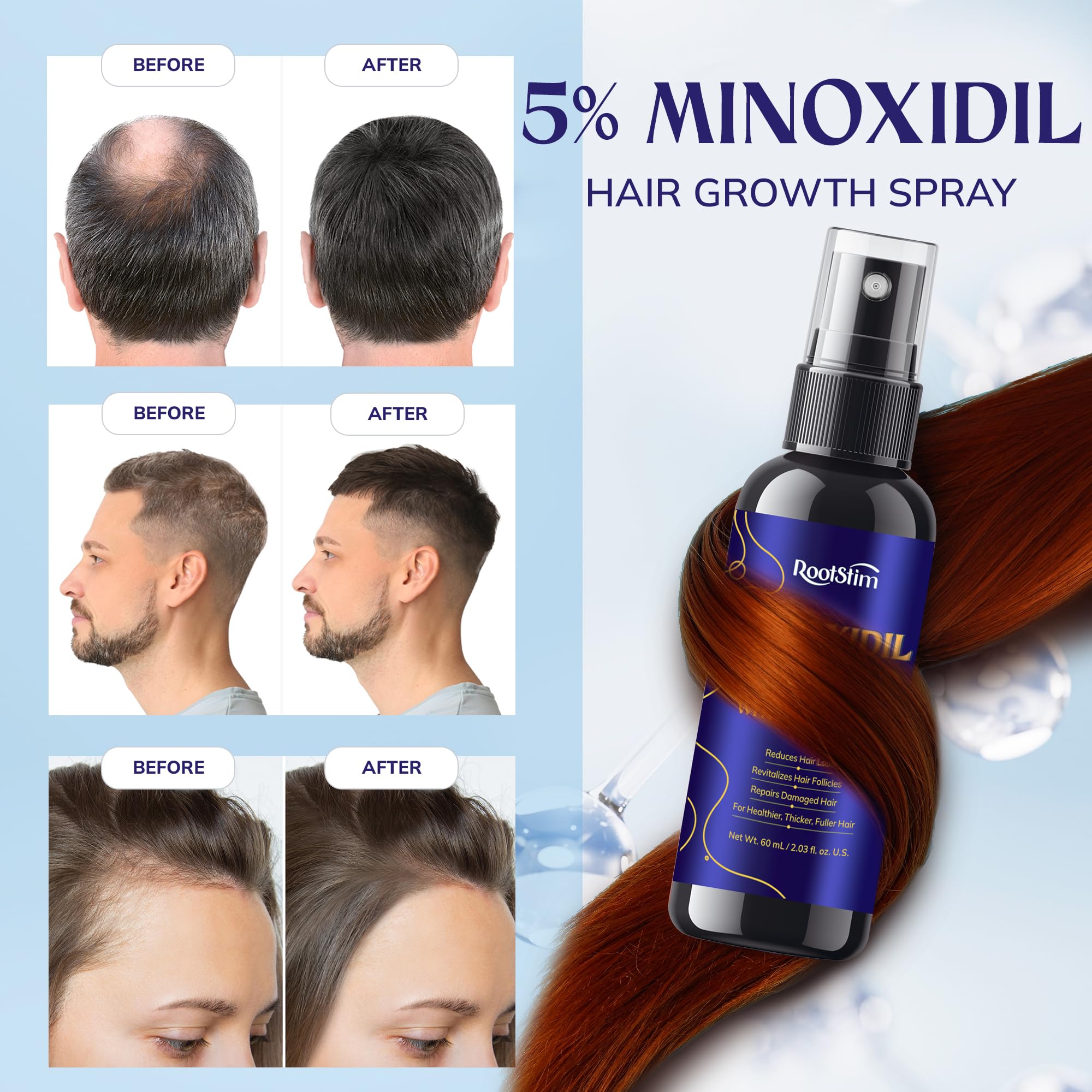 RootStim 3-pack packaging showing long-term hair care solution.