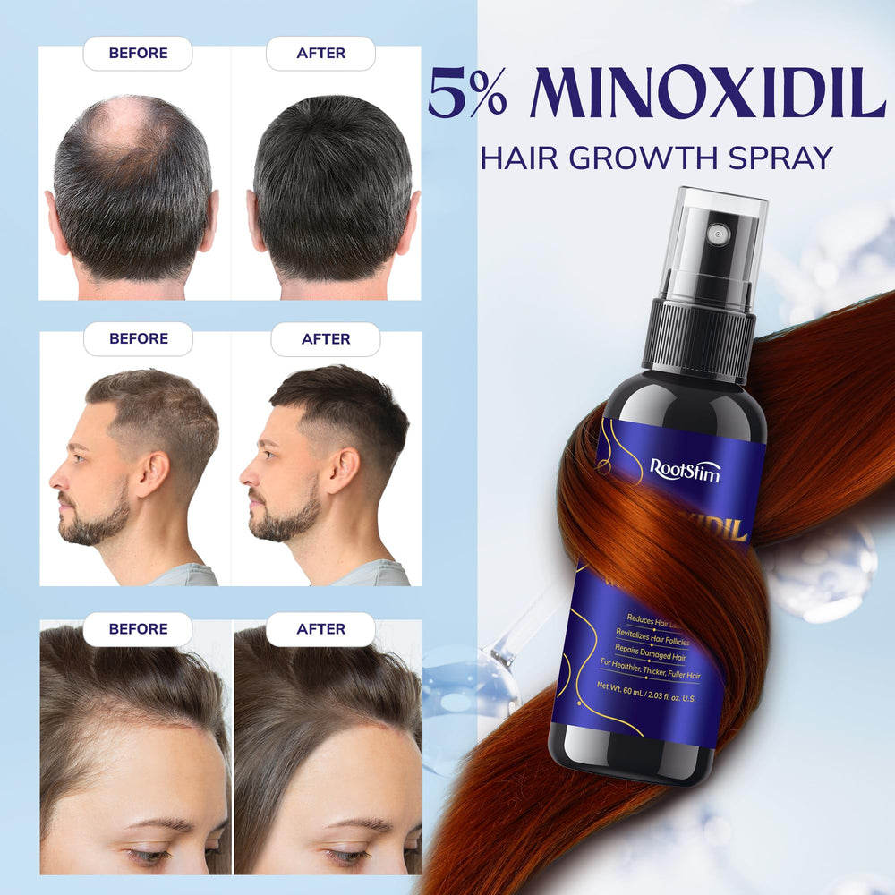 RootStim detailed application on dry hair demonstrates easy twice daily use