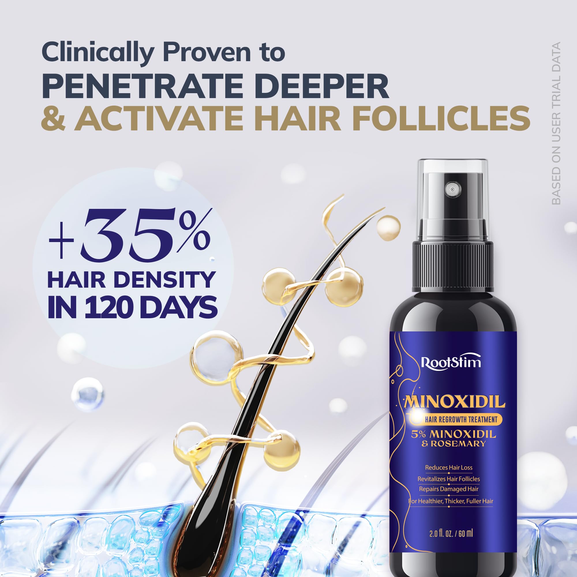 RootStim Minoxidil near hairline for improved appearance of density