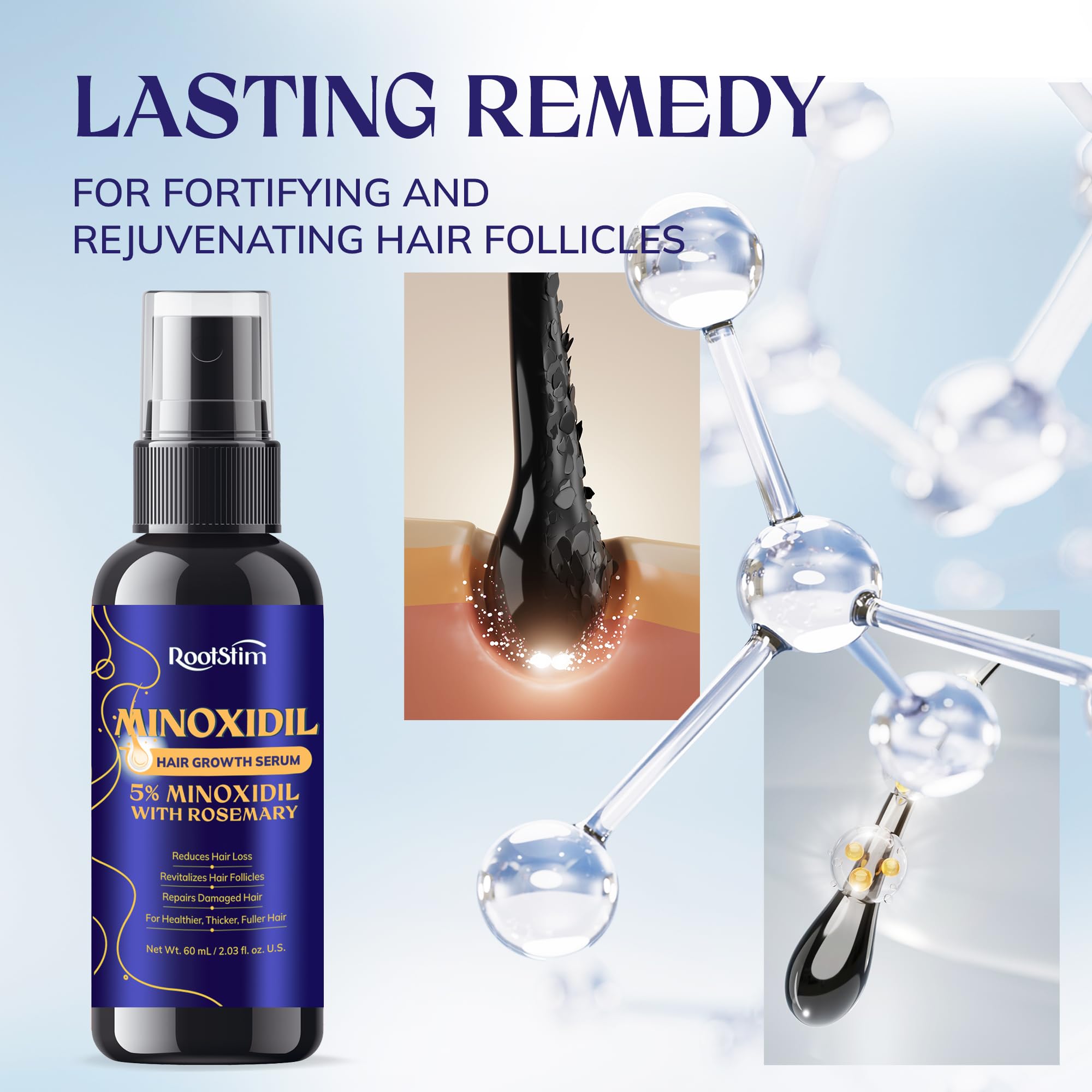 RootStim scalp area focus suggests targeted treatment for thinning areas