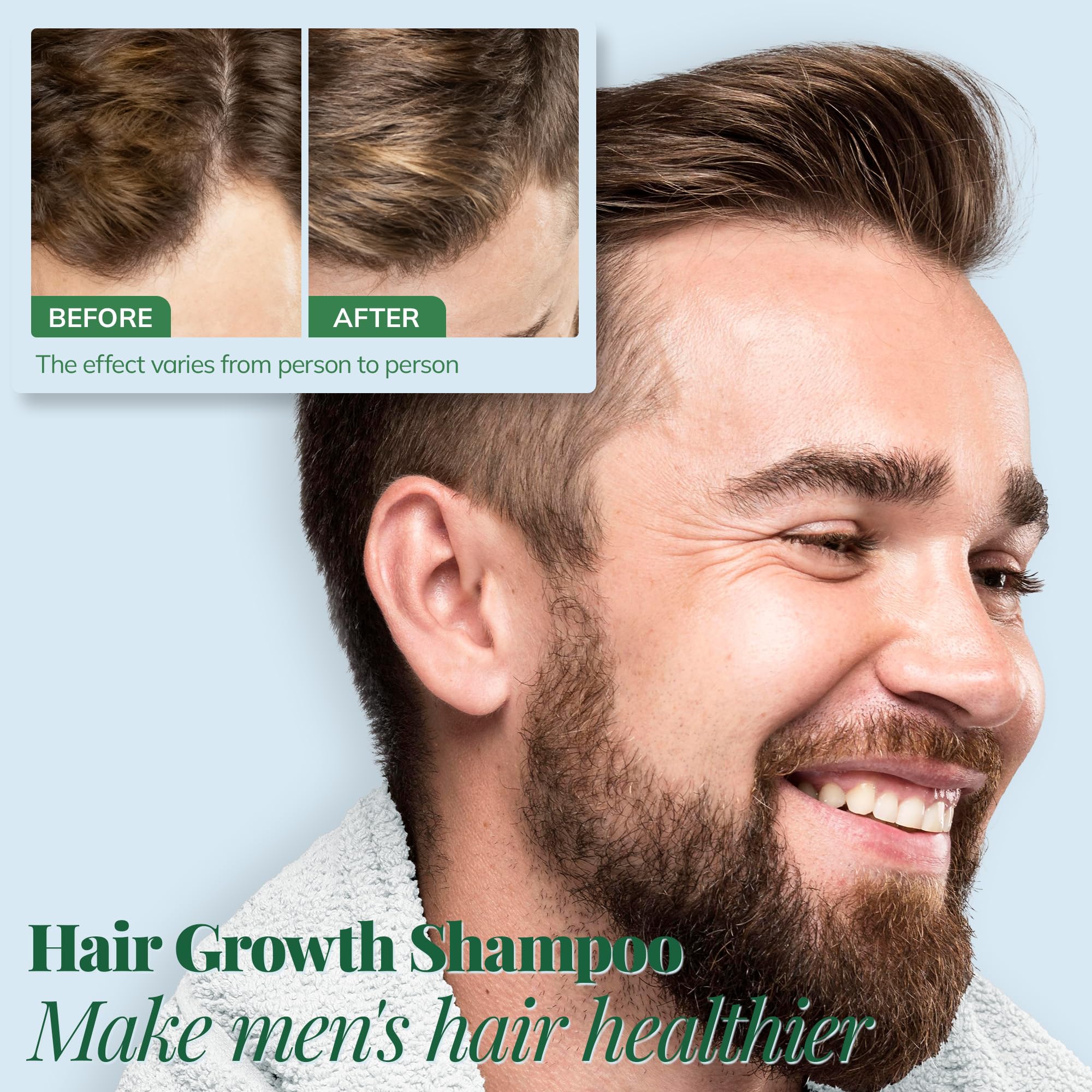 RootStim sulfate-free label signaling gentle scalp care