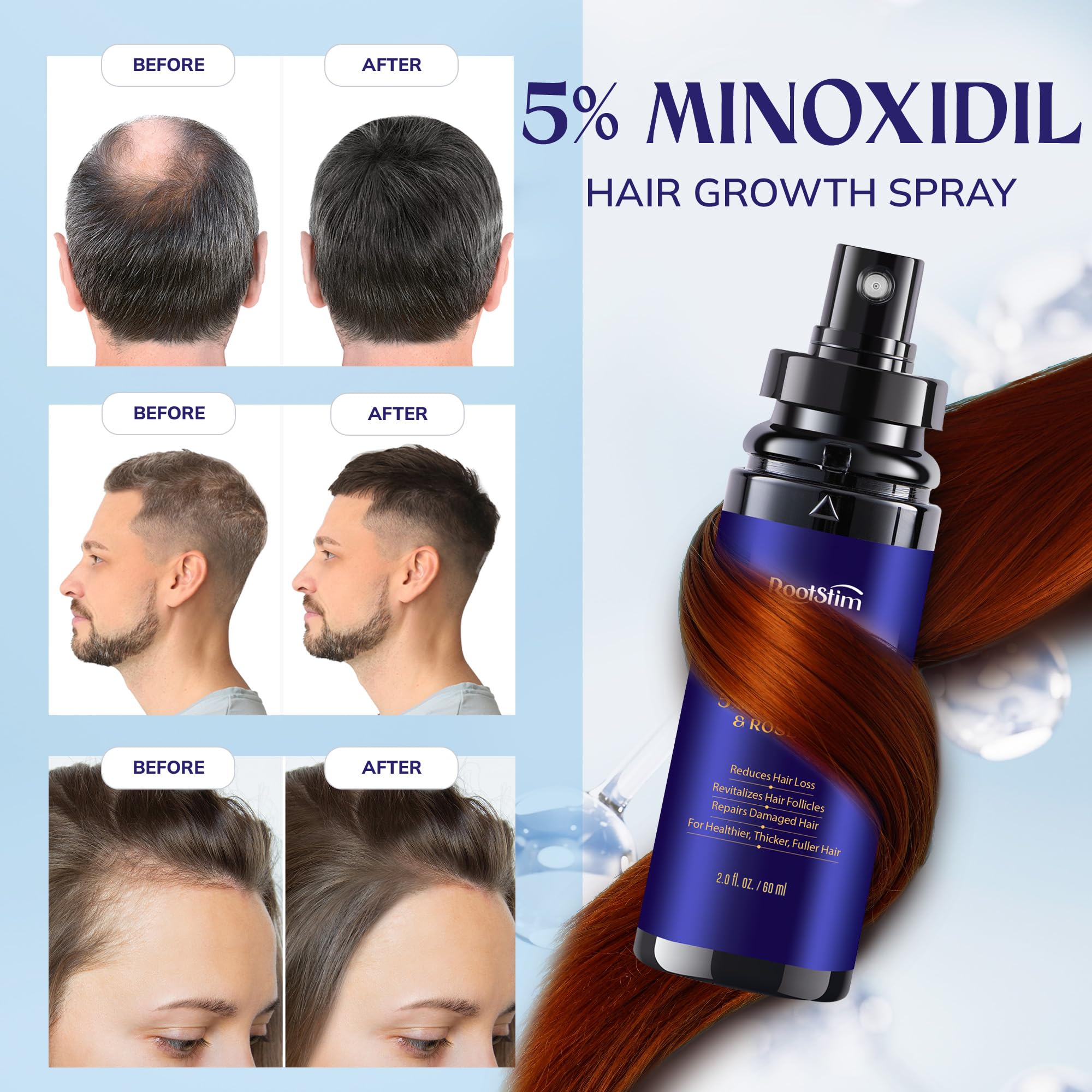 RootStim two-pack packaging for uninterrupted hair growth routine