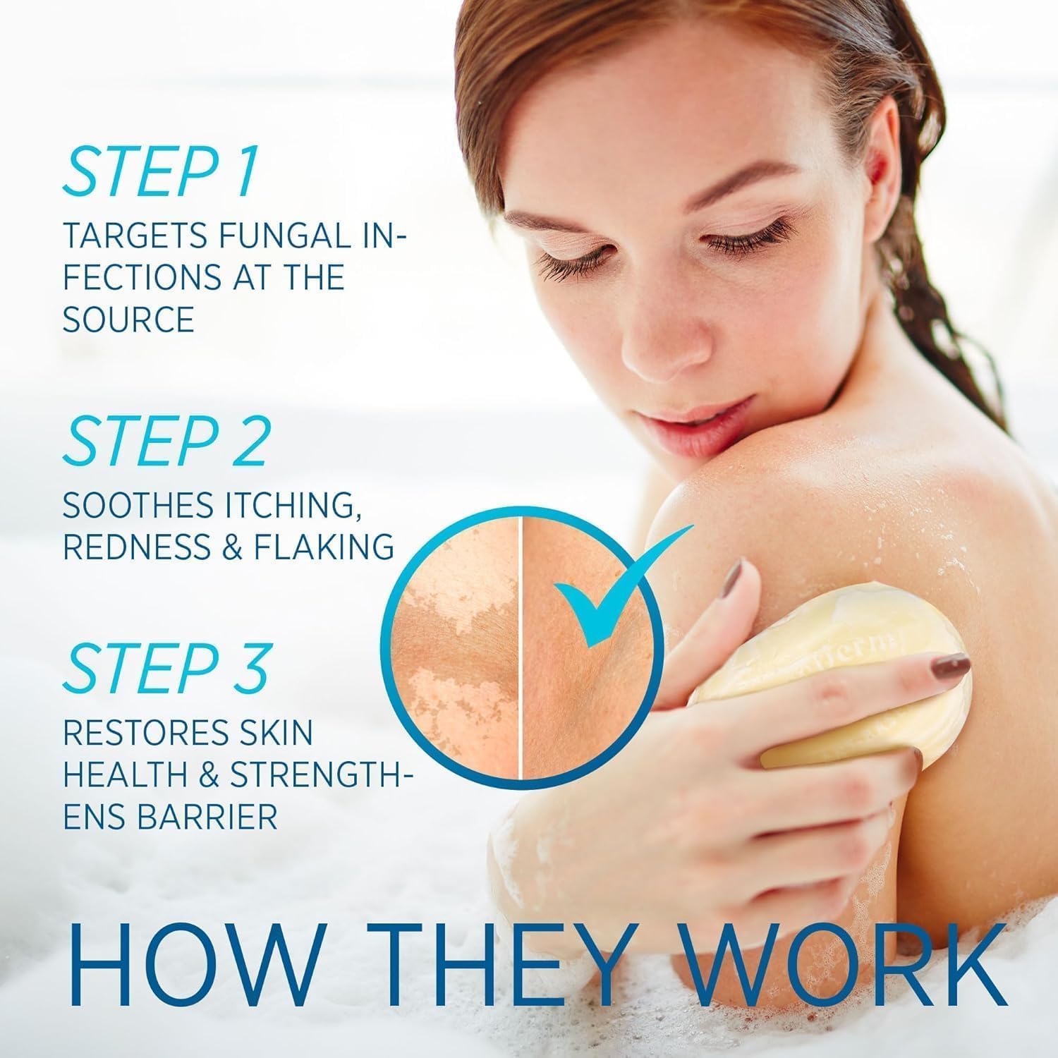 Roycederm cream on skin showing moisture balance and softness.